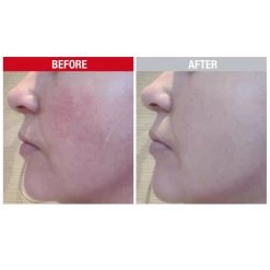 Altruist Zonnebrand Creme Anti-Roodheid En Pigment SPF50 -Kortingswinkel voor verzorgingsproducten 998063 3