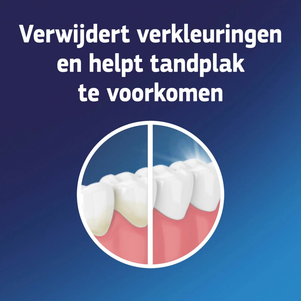 3x Fixodent Reinigingstabletten Complete Care 5 3x Fixodent Reinigingstabletten Complete Care - Image 3